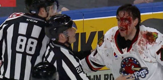 Brutal AHL fight leaves player bloodied Mathieu Olivier bloodies Kurtis Gabriel in AHL fight