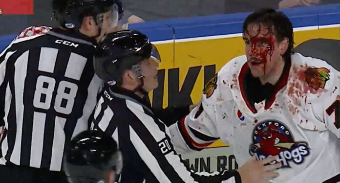 Brutal-fight-AHL Mathieu Olivier bloodies Kurtis Gabriel in AHL fight