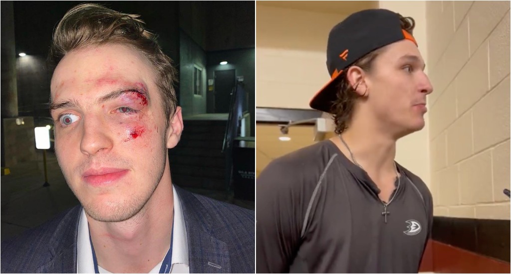 Trevor Zegras calls out Jay Beagle for fighting Troy Terry: 'Should be  f-ing punished' - The Daily Goal Horn