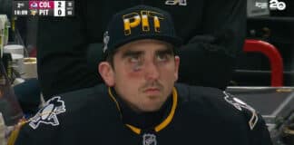 Penguins Backup Goalie Smoked With Puck While Sitting on Bench Alex Nedeljkovic hit in the face by puck