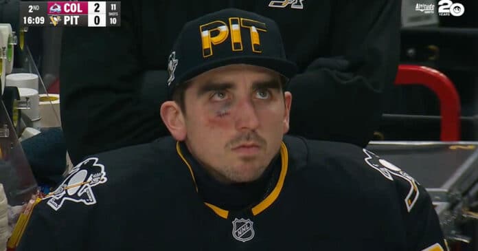 Alex-Nedeljkovic-puck-in-face Alex Nedeljkovic hit in the face by puck